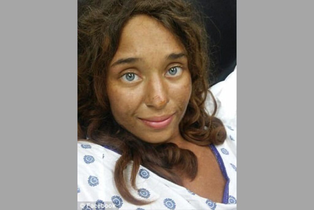 Lisa Theris was photographed in her hospital bed following her discovery.