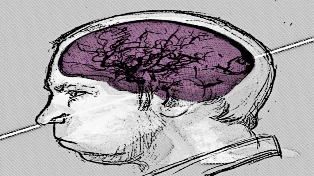 3D Digital Analysis of the Anatoli Bugorski accident. 
