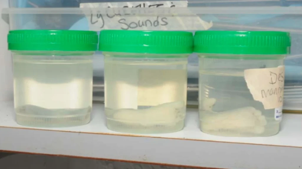 Grand Jury Report evidence showing fetal feet that Gosnell stored.