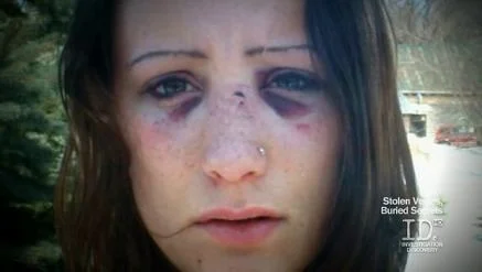 Brianna Maitland pictured with visible facial injuries after a reported assault before her 2004 disappearance.