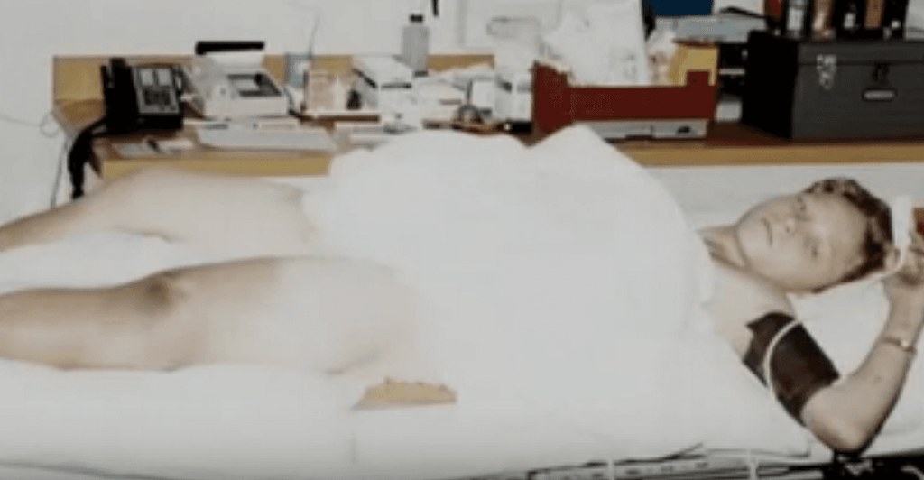 Thadius Phillips lying in a hospital bed following his rescue, resting on his side with his head on a pillow and his arm bent beneath it.
