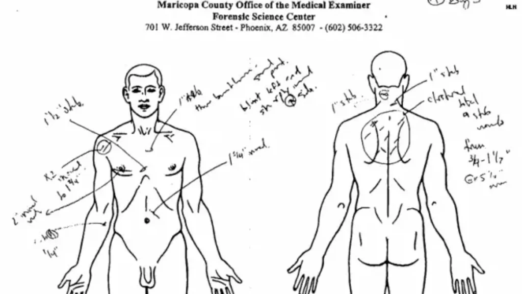 Official autopsy diagram from the Maricopa County Office of the Medical Examiner documenting the extensive stab wounds and lacerations