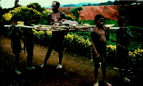 Four Fore boys carrying a boy suffering from kuru on a stretcher to a hospital in Papua New Guinea in 1957.